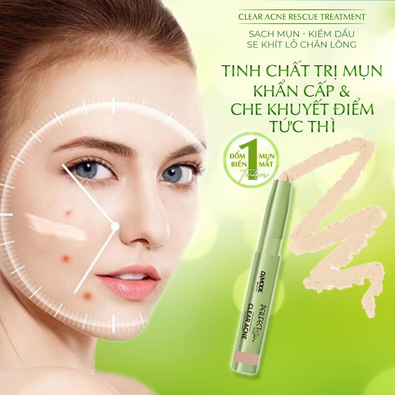 Rescue Treatment - Tinh Chất Trị Mụn Khẩn Cấp - Che Khuyết Điểm Tức Thì
