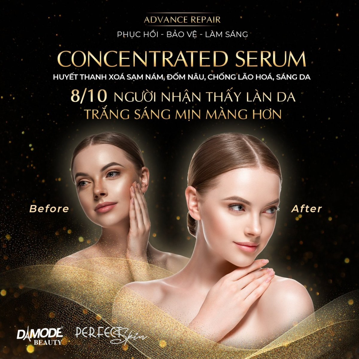 CONCENTRATED SERUM - Huyết Thanh Xoá Nám, Đốm Nâu, Chống Lão Hoá, Sáng Da